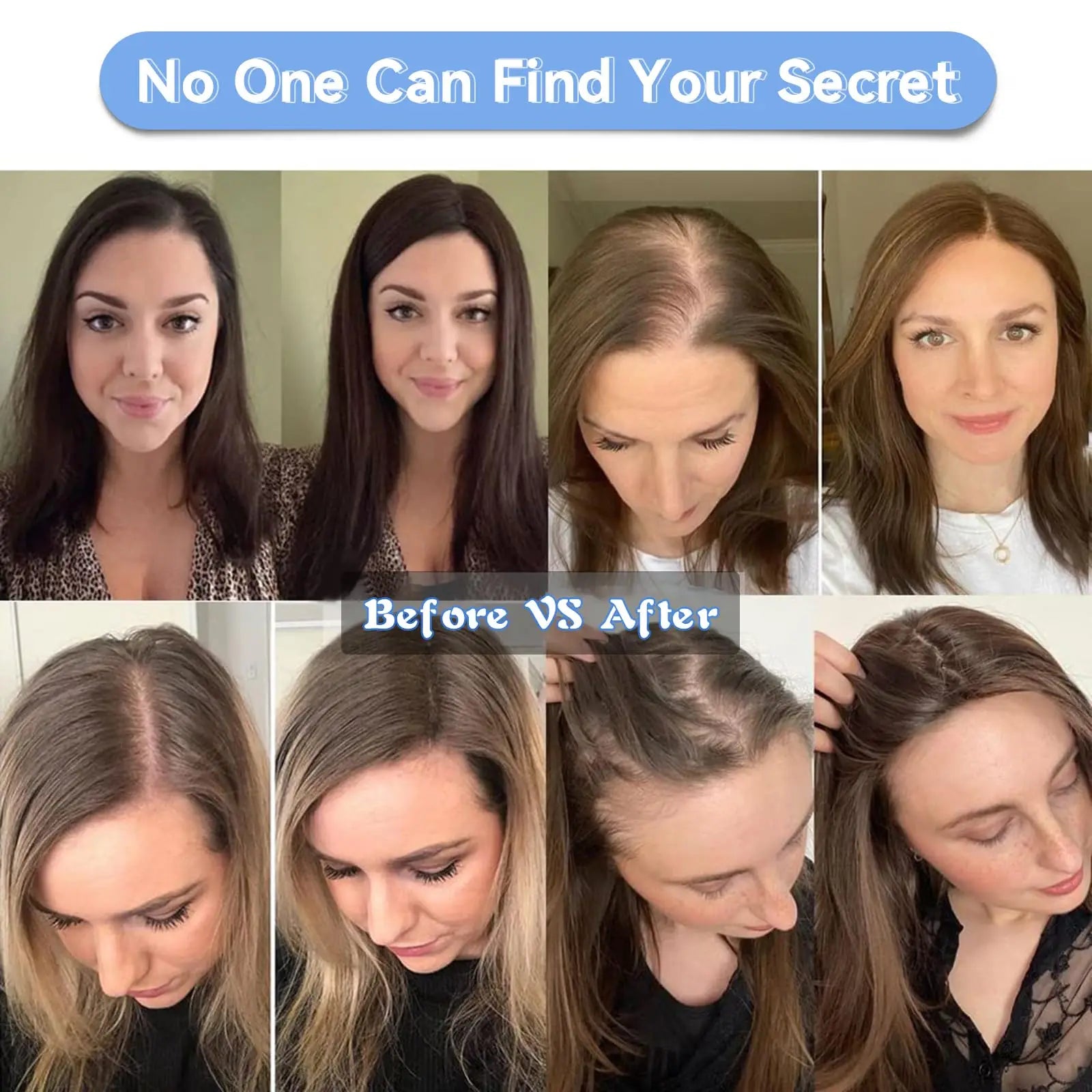 Ombre Ash Blonde Human Hair Topper | Silk Base Remy Hair Topper for Thinning Hair