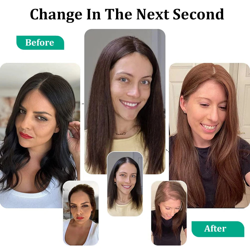 Remy Human Hair Topper for Thinning Hair – Clip-In Crown Volume 25–45 cm